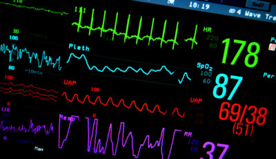 Non-invasive Multi-sensor to Predict Worsening Heart Failure