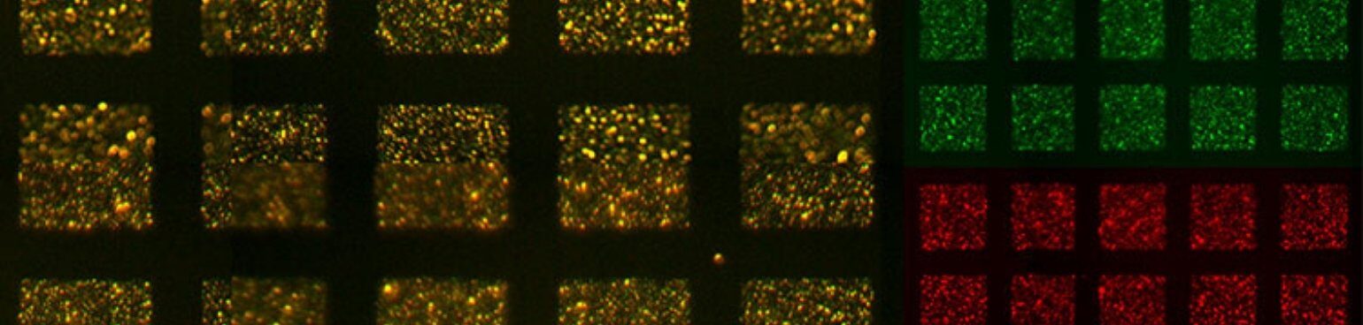 Microscope image of spike-liposomes showing in green in top right, ACE2 receptor cells showing in red in bottom right and composite proteins showing in gold on left.
